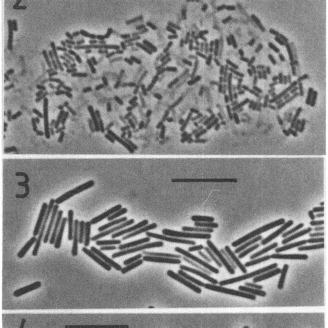 Phase contrast microscopy of some important lactic acid bacteria. 1 ...