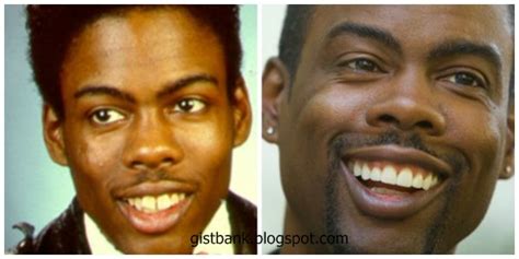 Celebrities Who Fixed There Teeth - Celebrities - Nigeria