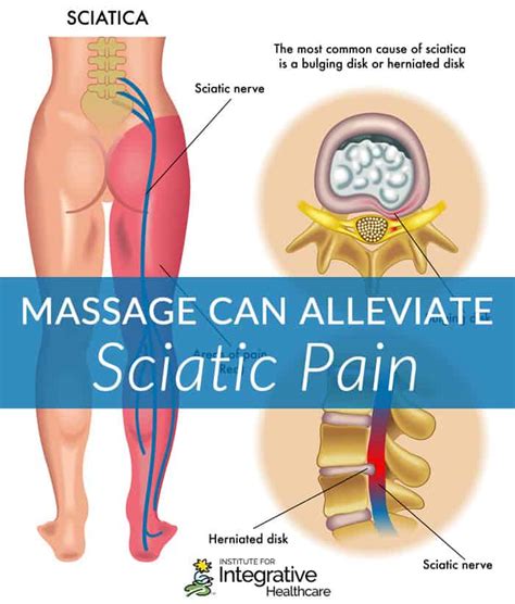 Massage Can Alleviate Sciatic Pain | Massage Professionals Update