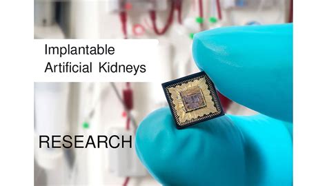 Research: Implantable Artificial Kidneys