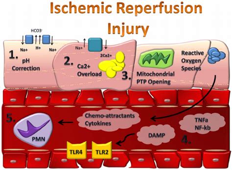 Mediators in Myocardial Reperfusion Injury | Download Scientific Diagram