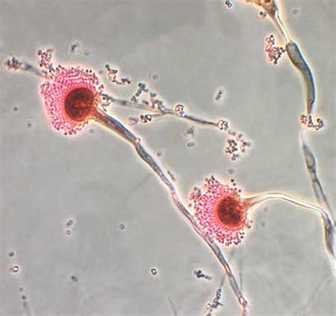 Aspergillus Mold In Lungs