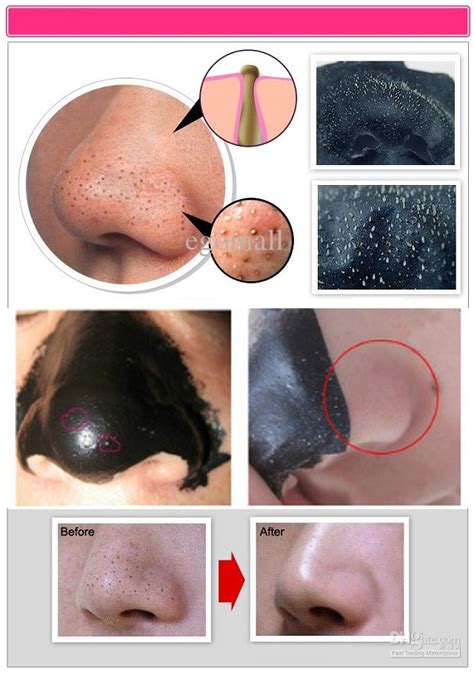 Blackheads Removing Mask - AllDayChic