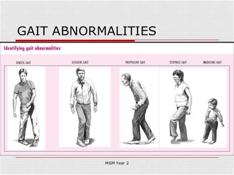 GAIT ABNORMALITIES MGM Year 2 Sjukgymnast, Neurologi, Fysik, Psykologi ...