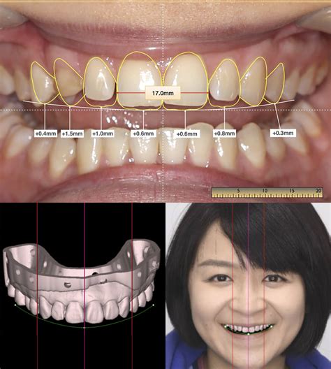 Digital Smile Design - Unley Dentist | Malvern Dental & Smile Design