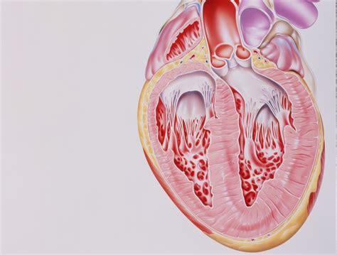 TAVR Risky for Dialysis Patients - Renal and Urology News