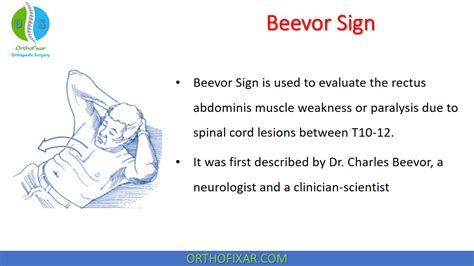 Beevor Sign • Easy Explained - OrthoFixar 2022 in 2024 | Muscle weakness, Spinal cord lesions ...