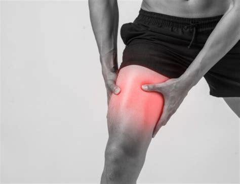 What is a Dead Leg and How to Deal with It - Sport Doctor London