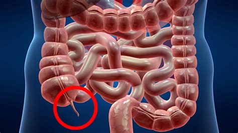 Diagram Showing Location Of Appendix