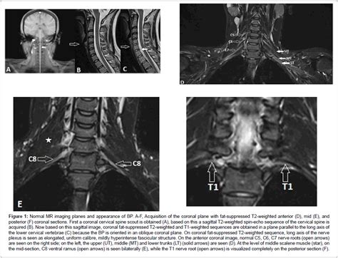 nuclear-medicine-imaging-planes