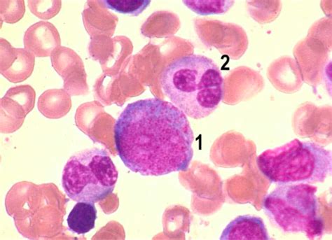 WBC morphology Flashcards | Quizlet