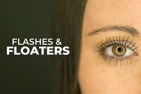 Should You Worry About Eye Flashes and Floaters? - EZOnTheEyes