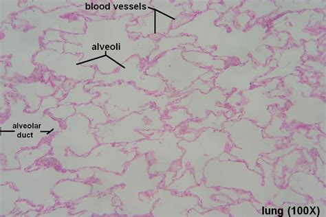 Alveoli – Tutorial – Histology Atlas for Anatomy and Physiology