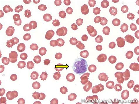 Promonocyte