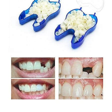 Xizioo Occlude Temporary Dentures Upper Dentures Veneers Dentures ...