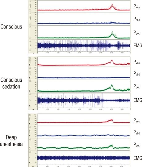 Figure 1:Effects of Level of Consciousness on Urodynamic Procedure in Female Cats- Open-i