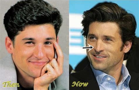 Patrick Dempsey Nose Job Before And After Pictures | 2018 Plastic ...