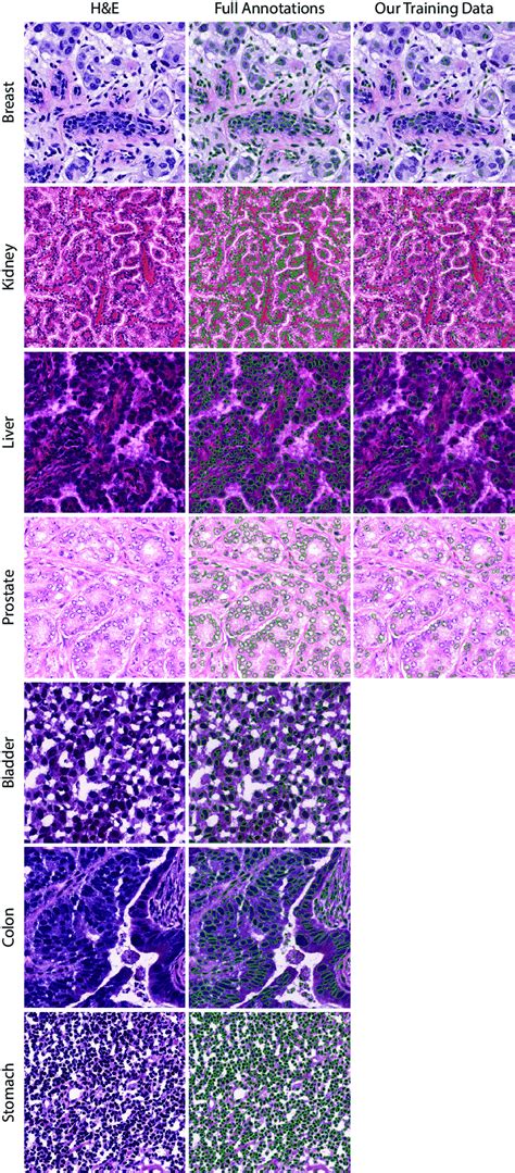 Examples of histopathology images for different organs (rows) showing ...