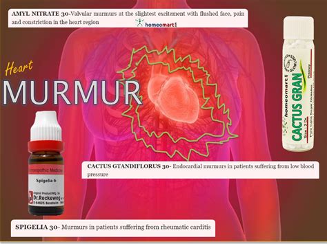 heart murmur treatment homeopathy - Homeomart Blog