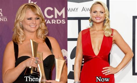 Miranda Lambert weight loss before and after - Latest Plastic Surgery ...