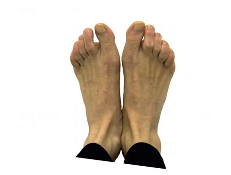 Initial exercises – Treatment of Hallux valgus and Haluks – CompleVita