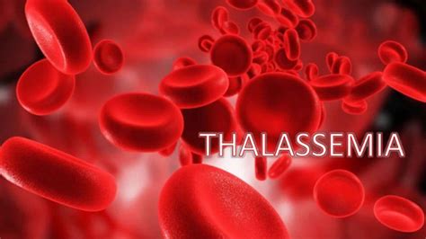 Thalassemia intermedia, beta thalassemia intermedia causes, symptoms, treatment & prognosis