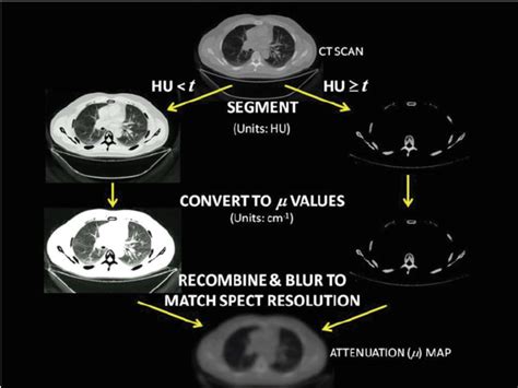 The steps involved in converting from a CT scan to linear attenuation ...