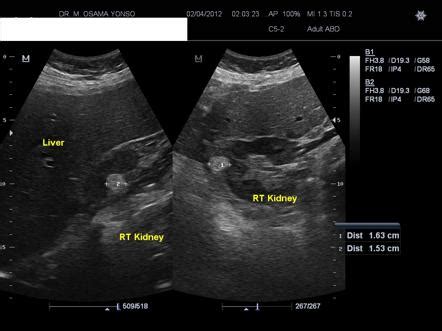 Viewing playlist: 10.6.2016 | Radiopaedia.org