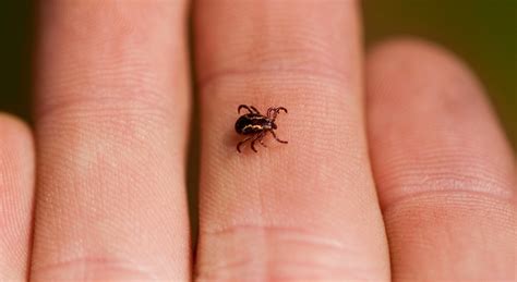 Ticks and what to watch for when they bite | Norton Children's Louisville, Ky.