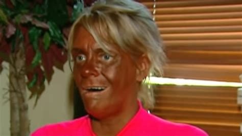 Mom-of-5 obsessed with tanning was accused of “burning” her 6-year-old ...