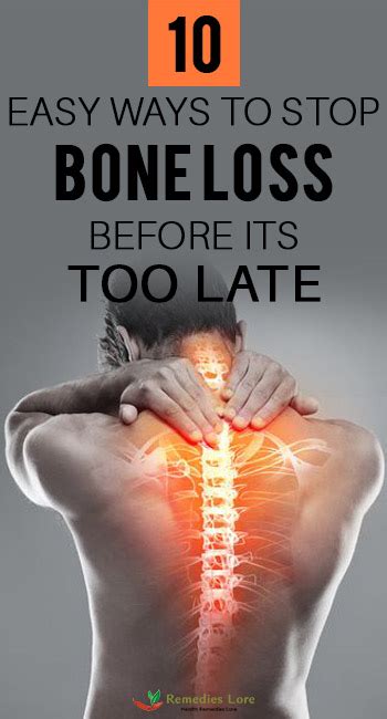 10 Easy Ways To Stop Bone Loss Before Its Too Late - Remedies Lore