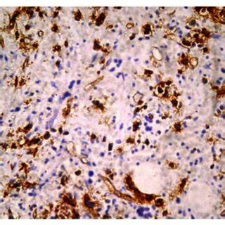 shows flowcytometric analysis on peripheral blood of CD34 antigen on... | Download Scientific ...