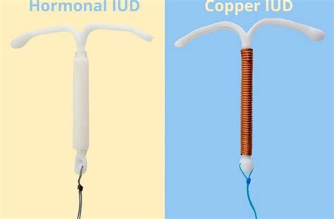 Copper Iud Insertion