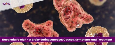 Naegleria Fowleri - Brain-Eating Amoeba: Causes, Symptoms & Treatment