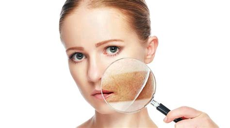 Skin Pigmentation: Experts reveal the causes and treatments of the ...