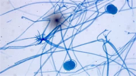 Mucor And Rhizopus