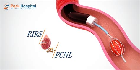 Kidney Stone Surgery Procedure- RIRS V/s PCNL