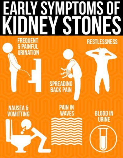 How to Get Rid of Kidney Stones - Herbal Remedies