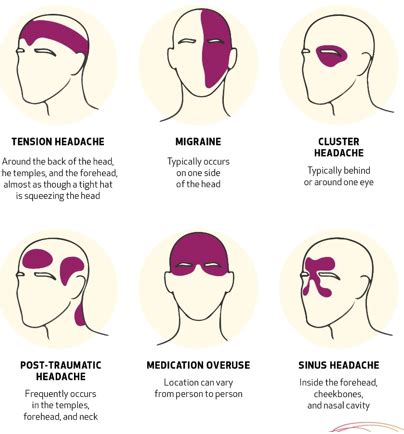 Types of Headaches: Symptoms, Causes And Treatment – Latest News Headlines l Politics, Cricket ...