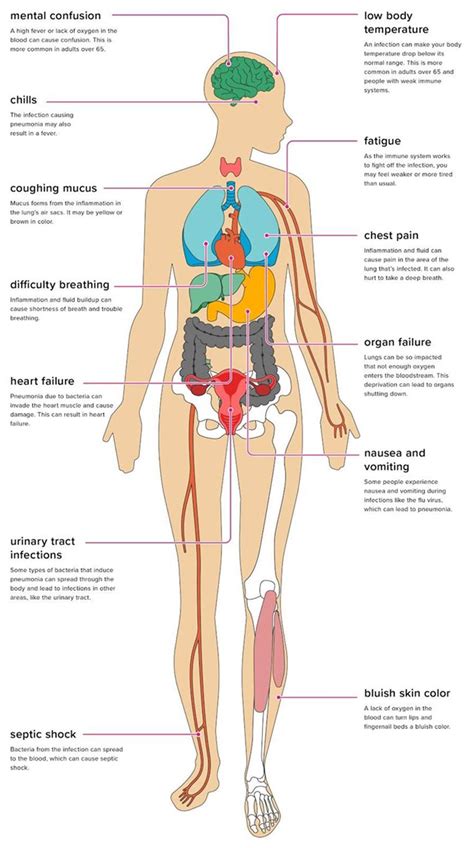 Pneumonia Lungs Diagram