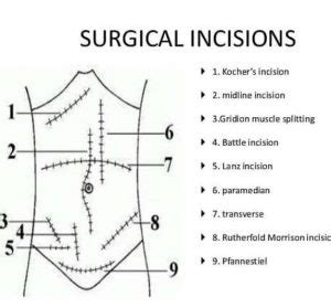 Abdominal Incisions in Gynaecologic Oncological Surgery – The Operating ...