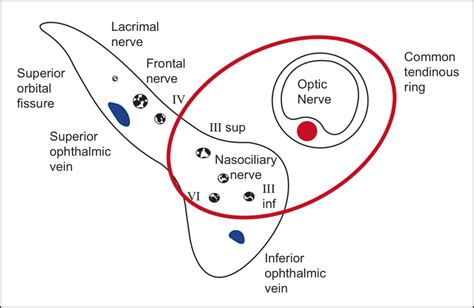 Superior Orbital Fissure Cranial Nerves