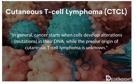 Insights Into The Cutaneous T-cell Lymphoma Treatment Market | by Delveinsight | Medium