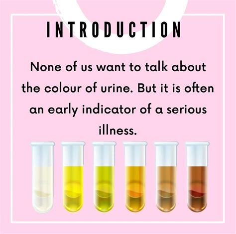 infographics urologist uc irvine department of urology - mrs pip | urine color chart kidney ...