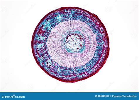 Plant Tissues Under the Microscope in the Laboratory. Stock Photo - Image of chloroplast ...