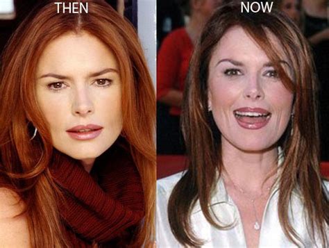 Roma Downey Plastic Surgery Before And After Photos - CelebLens.Com