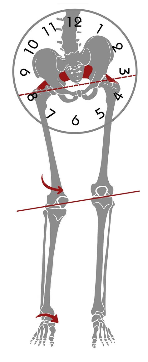 Piriformis Muscle, Sacroiliac, Scoliosis Exercises, Back Pain Exercises, Stretching Exercises ...