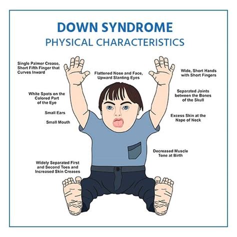 Down Syndrome-Related Research and Genetic Counseling: Empowering ...