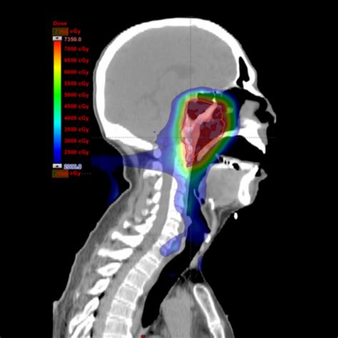 Proton Beam Medical Dosimetry Certificate | Legion Healthcare Partners