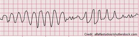 Fluoroquinolones (Quinolones) Nursing Antibiotic Pharmacology Review